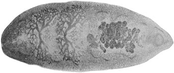 Human intestinal fluke (Fasciolopsis buskii)